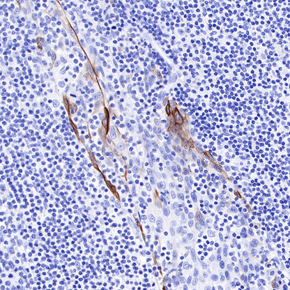 Keratin 17 Recombinant Rabbit mAb (SDT-011-43)