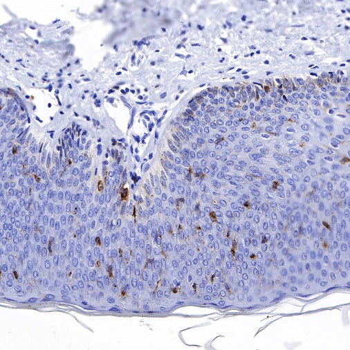 Langerin Recombinant Rabbit mAb (SDT-450-47)