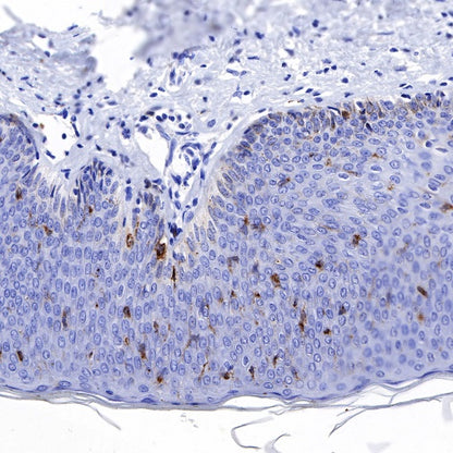 Langerin Recombinant Rabbit mAb (SDT-450-47)
