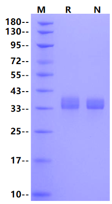MMP-2 His Tag Protein, Mouse
