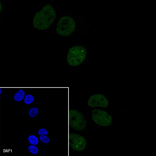 p21 Waf1/Cip1 Mouse mAb (469-2)