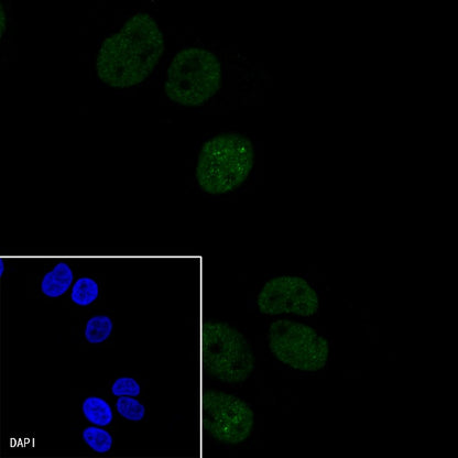 p21 Waf1/Cip1 Mouse mAb (469-2)