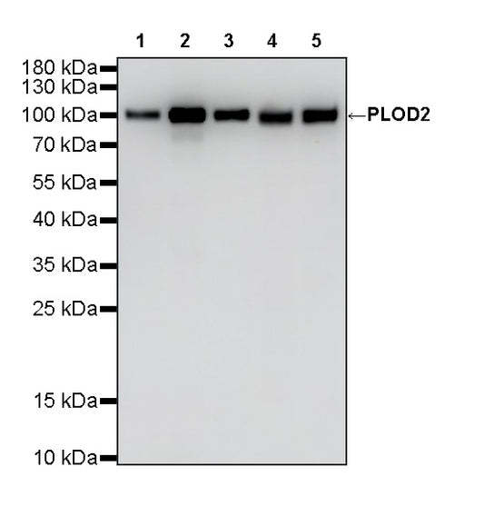 PLOD2 Mouse mAb