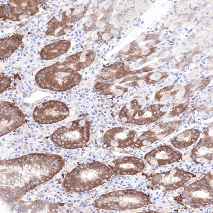 Hsp90 beta Recombinant Rabbit mAb (SDT-R033)