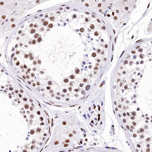 Cyclin K Recombinant Rabbit mAb (S-1586-18)