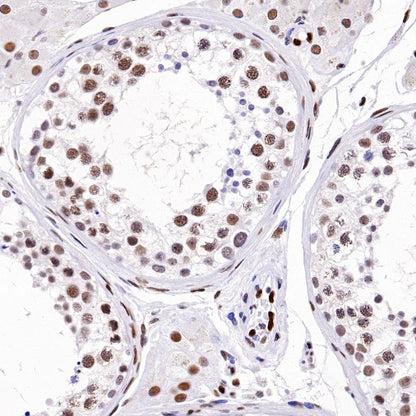 Cyclin K Recombinant Rabbit mAb (S-1586-18)