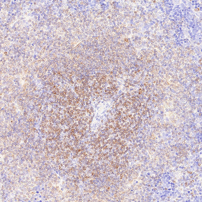Bcl-2 Recombinant Rabbit mAb (S-3910-3)