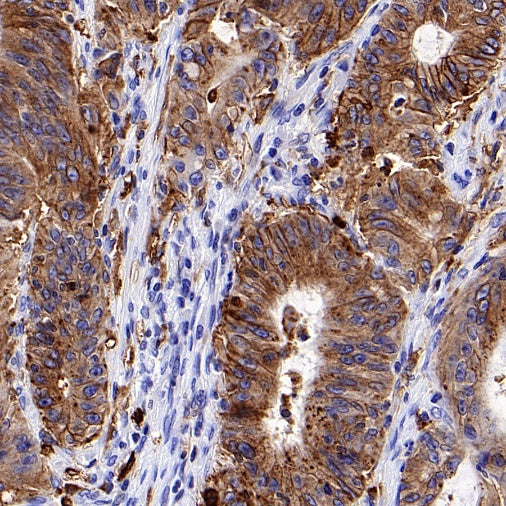 HLA-DRA Rabbit Polyclonal Antibody