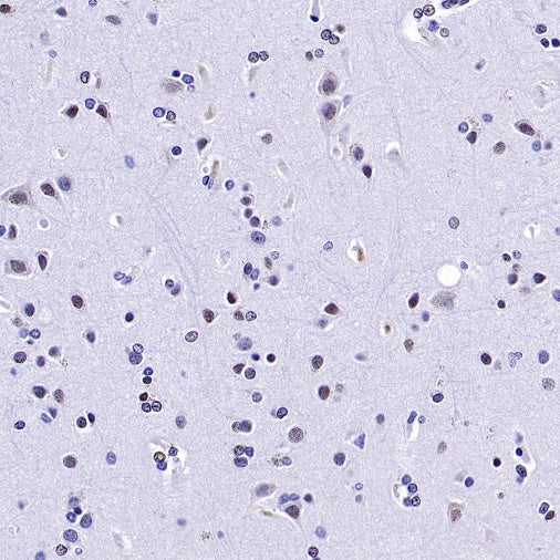 Histone H3 (mono methyl K36) Recombinant Rabbit mAb (S-859-505)
