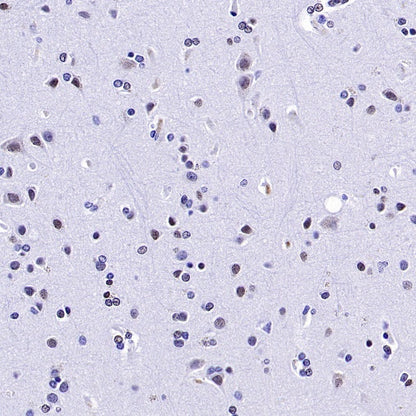 Histone H3 (mono methyl K36) Recombinant Rabbit mAb (S-859-505)