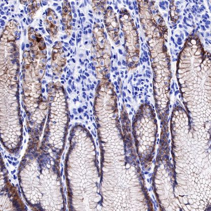 Claudin18.2 Recombinant Rabbit mAb,PBS Only (SDT-102-24)