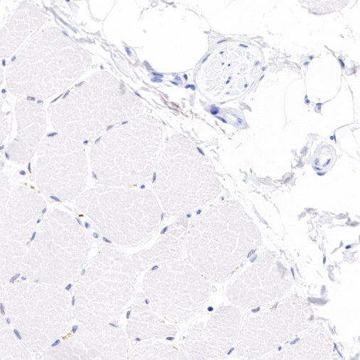 Tissue factor Recombinant Rabbit mAb (S-893-34)