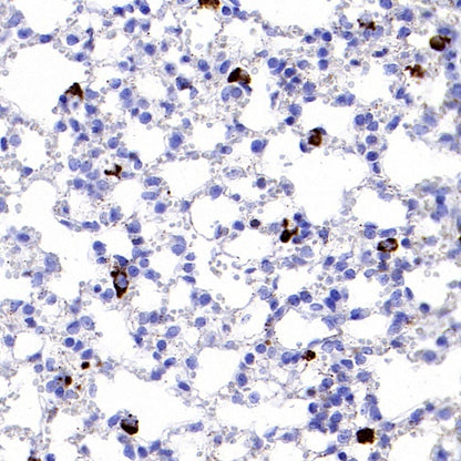 Cathepsin D Recombinant Rabbit mAb (S-R208)