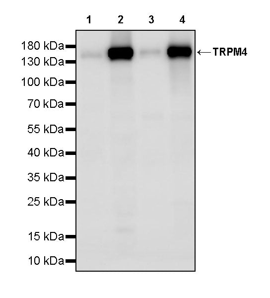 TRPM4 Recombinant Rabbit mAb (S-3948-2)