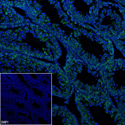 RNF17 Recombinant Rabbit mAb (S-3660-61)