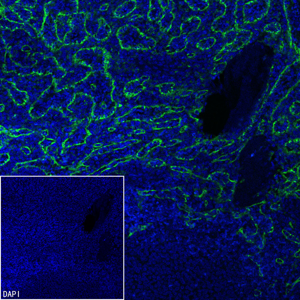 CD206 Recombinant Rabbit mAb (S-3477-27)