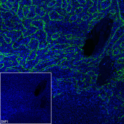 CD206 Recombinant Rabbit mAb (S-3477-27)