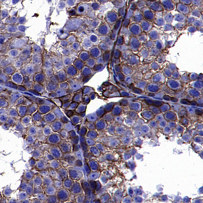 SLC7A5 Recombinant Rabbit mAb (S-4496-55)