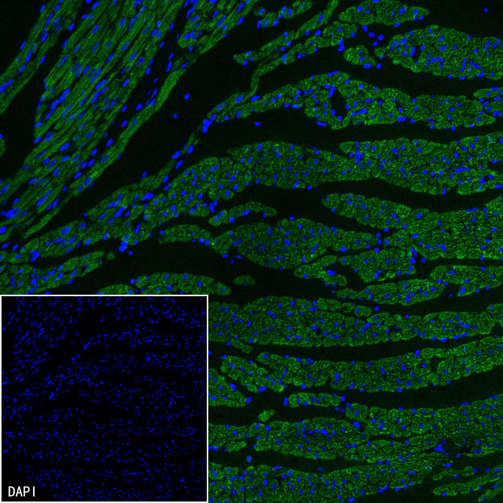 CHCHD10 Recombinant Rabbit mAb (S-4106-13)