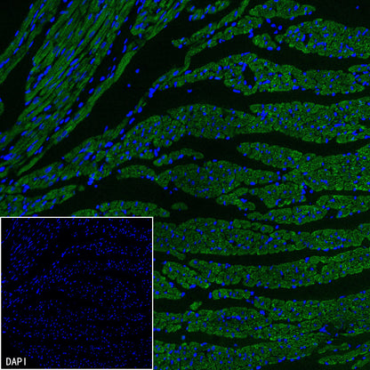 CHCHD10 Recombinant Rabbit mAb (S-4106-13)