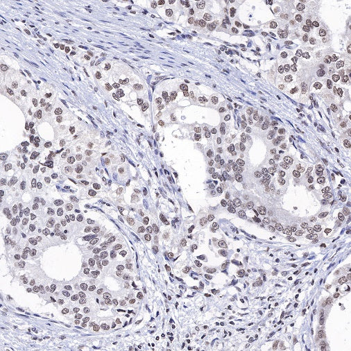 Histone H3 (mono methyl K4) Rabbit polyclonal antibody
