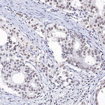Histone H3 (mono methyl K4) Rabbit polyclonal antibody