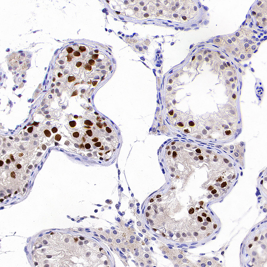 ATAD2 Recombinant Rabbit mAb (S-4145-63)