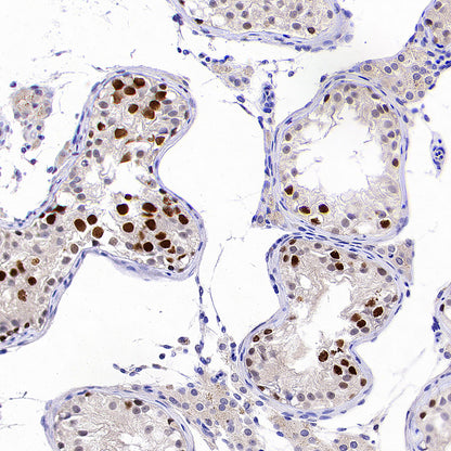 ATAD2 Recombinant Rabbit mAb (S-4145-63)