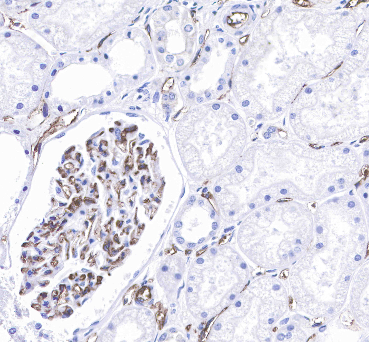 CD31 Recombinant Rabbit mAb,PBS Only (SDT-008-17)