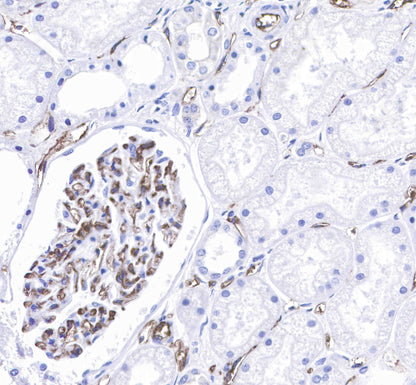 CD31 Recombinant Rabbit mAb,PBS Only (SDT-008-17)