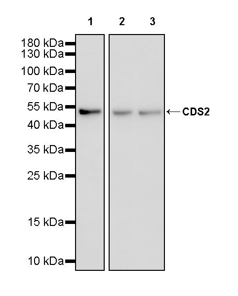 CDS2 Recombinant Rabbit mAb (S-3670-56)