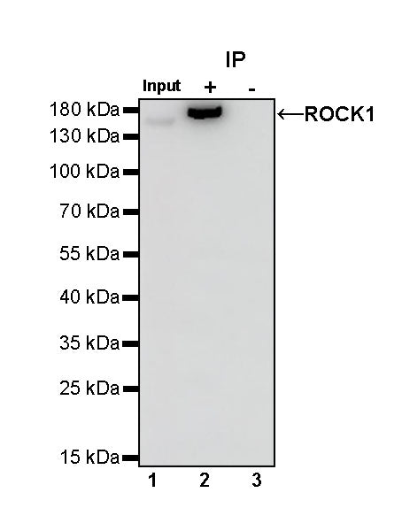 ROCK1 Recombinant Rabbit mAb (S-1304-153)