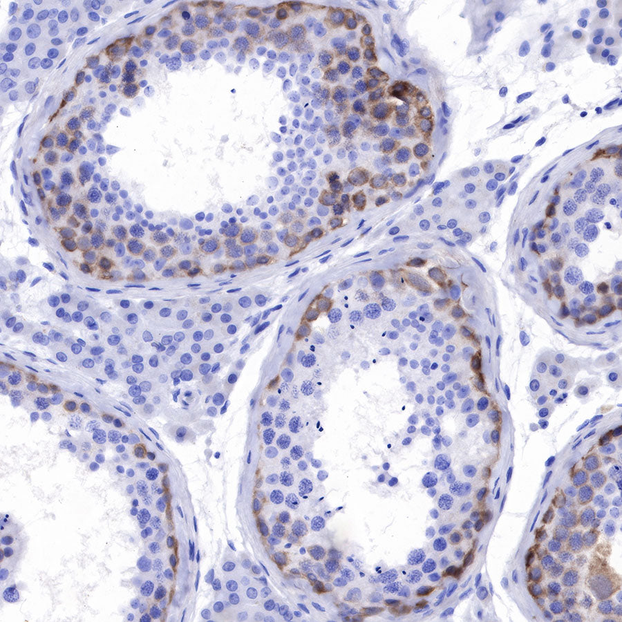 NY-ESO-1 Recombinant Rabbit mAb (SDT-R154)