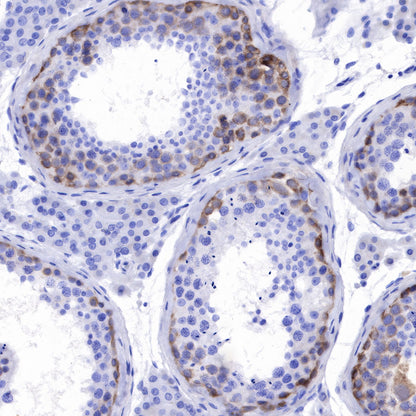 NY-ESO-1 Recombinant Rabbit mAb (SDT-R154)