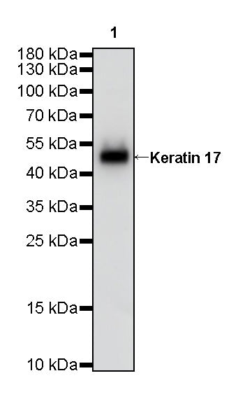 Keratin 17 Recombinant Rabbit mAb (SDT-011-43)