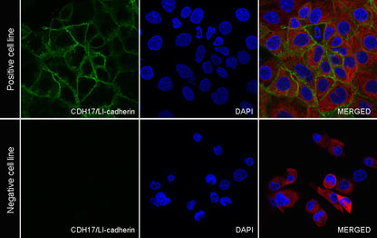 CDH17 Recombinant Rabbit mAb (SDT-3276-83)