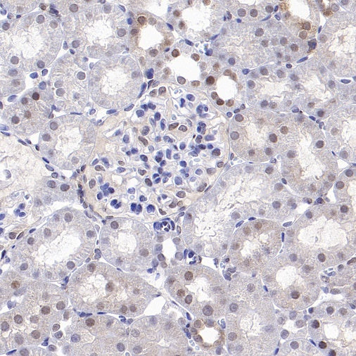 SMAD2 Recombinant Rabbit mAb (S-1521-177)