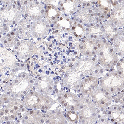 SMAD2 Recombinant Rabbit mAb (S-1521-177)