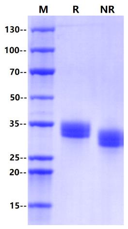 PD-L1 His Tag Protein, Human