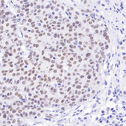 FOXA1 Recombinant Rabbit mAb (SDT-2779-17)