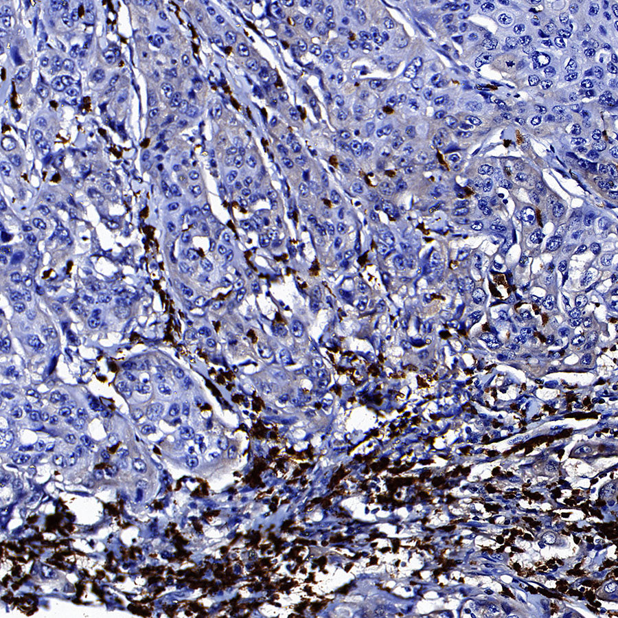MMP-8 Recombinant Rabbit mAb (S-5674)