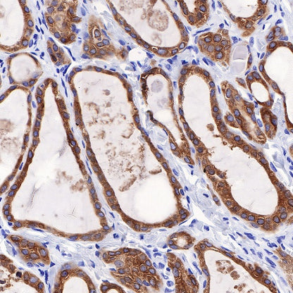 TPO Recombinant Rabbit mAb (SDT-420-57-1)