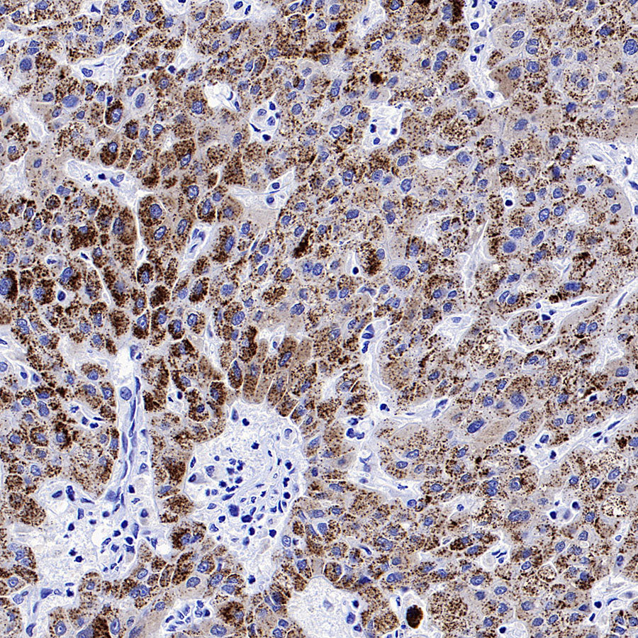 AGXT Recombinant Rabbit mAb (S-3586-30)