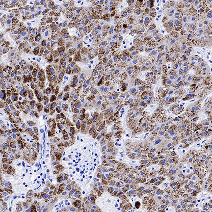 AGXT Recombinant Rabbit mAb (S-3586-30)