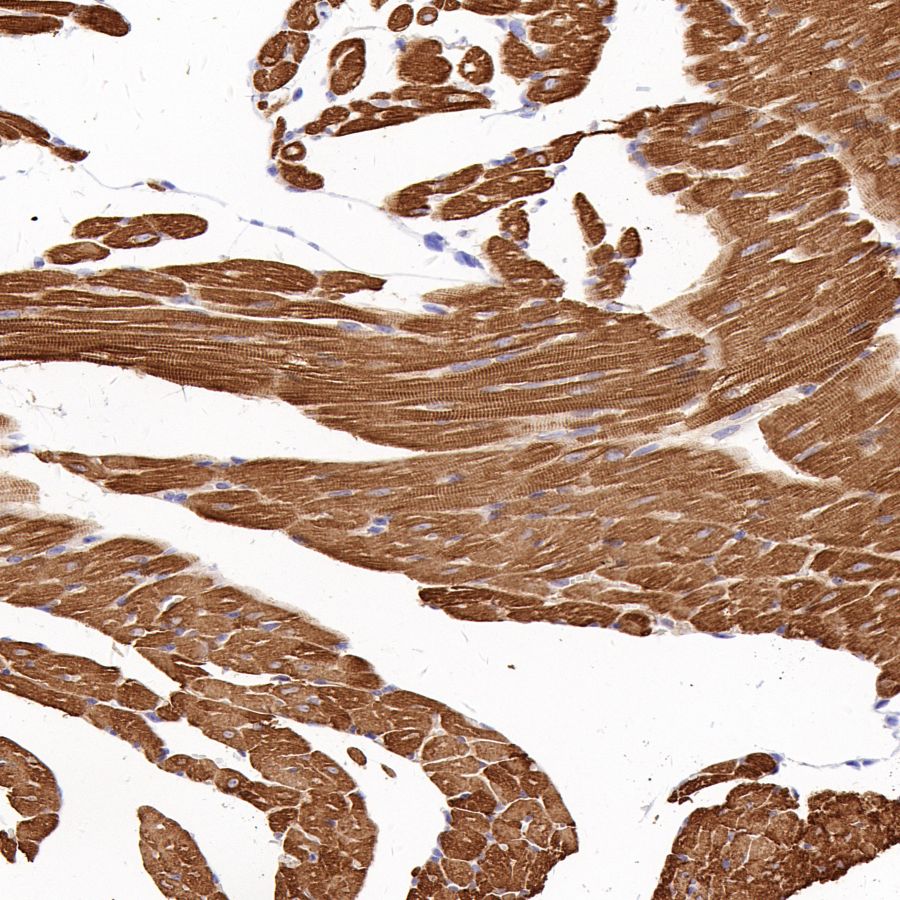 Myosin Light Chain 2/MLC-2V Rabbit Polyclonal Antibody