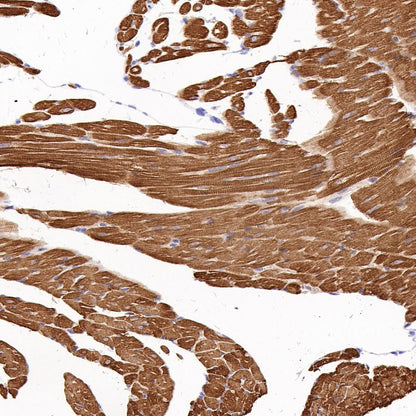 Myosin Light Chain 2/MLC-2V Rabbit Polyclonal Antibody