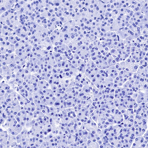 Myelin Basic Protein Recombinant Rabbit mAb (S-582-79)