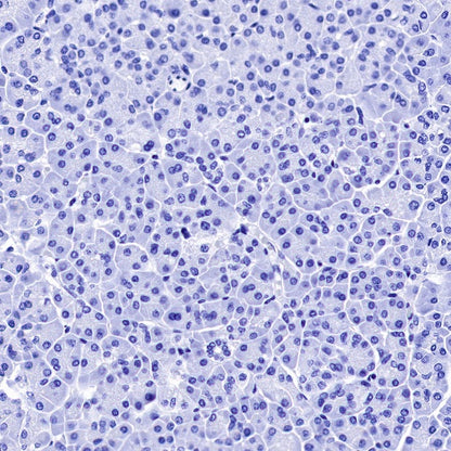 Myelin Basic Protein Recombinant Rabbit mAb (S-582-79)