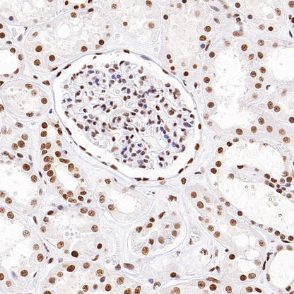 HDAC3 Recombinant Rabbit mAb (S-1977-31)