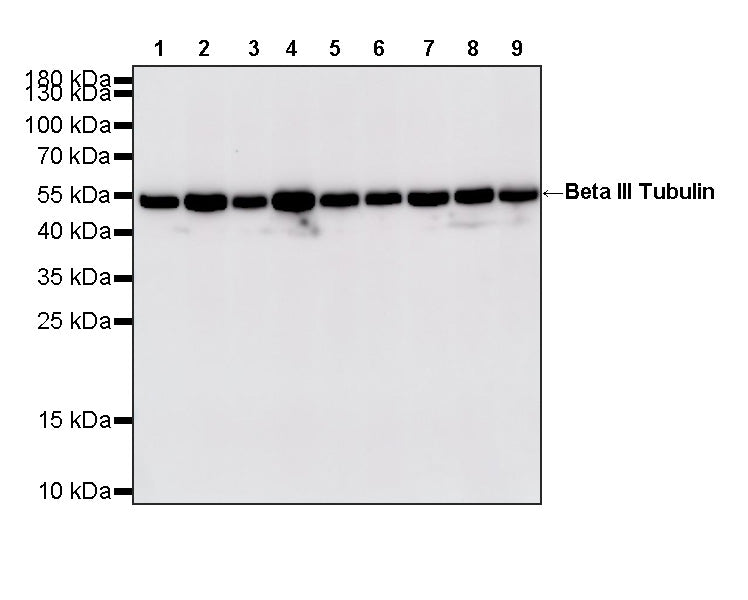 Beta III Tubulin Recombinant Rabbit mAb (S-5529)